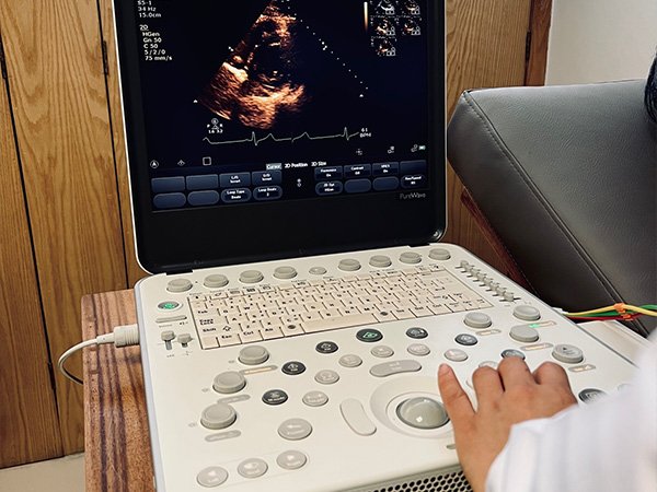 holter 24 y 48 horas