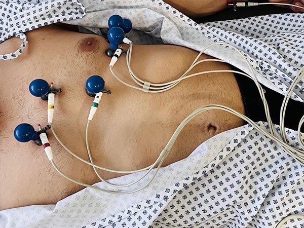 holter 24 y 48 horas